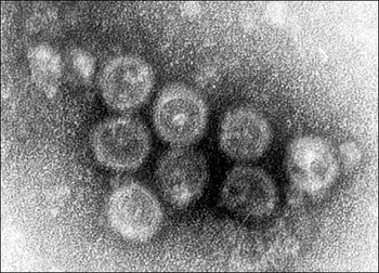 風疹ウイルス.jpg